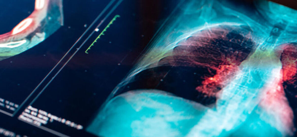 Imaging Excellence: Navigating Radiology Expertise for Precision Diagnostics
